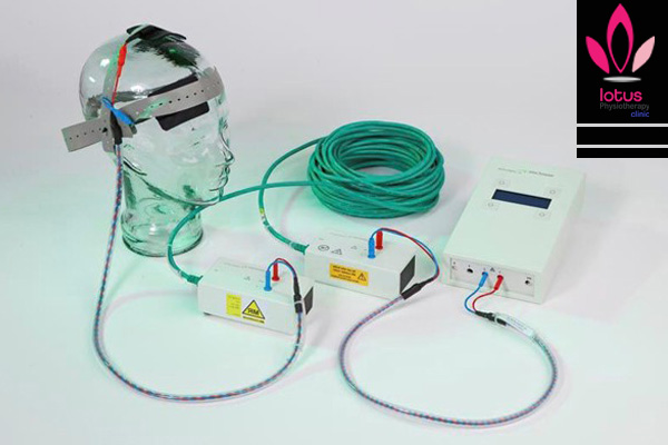بازتوانی پس از سکته مغزی با استفاده از TDCS