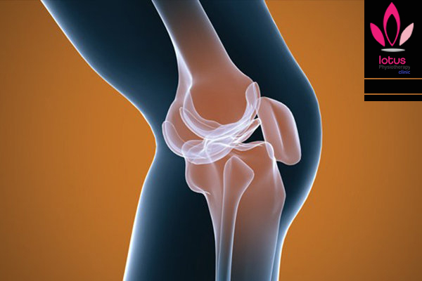 آرتروز زانو (Knee Osteoarthritis)/فیزیوتراپی در امیرآباد